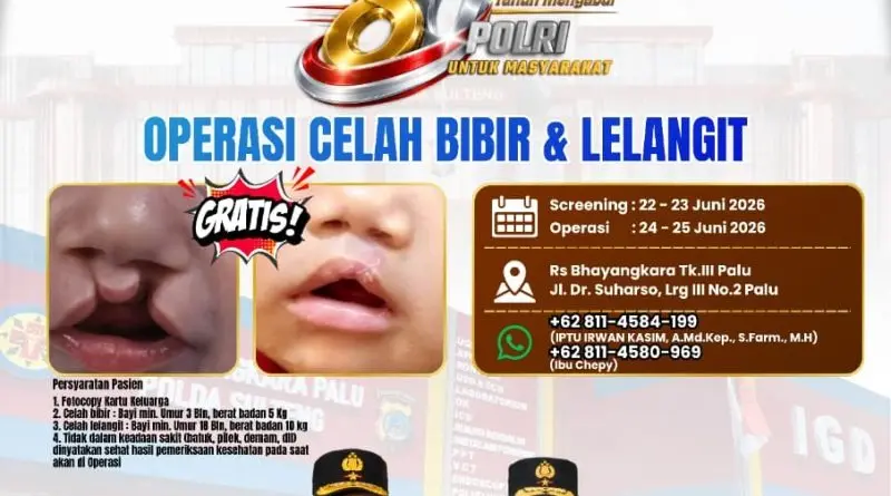 central-sulawesi-police-offer-free-surgeries-for-bhayangkara-day